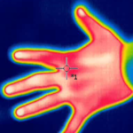 Infrared thermography image of a hand